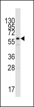 PPAT Antibody (Center)