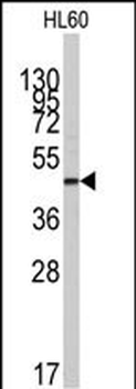 ZIC3 Antibody (N-term)