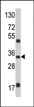 M6PR Antibody (N-term)