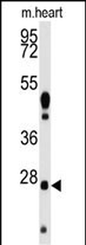 WDYHV1 Antibody (Center)
