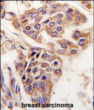 WDYHV1 Antibody (Center)