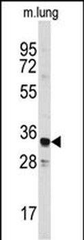 ANXA3 Antibody (Center)
