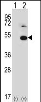 TRIP13 Antibody (N-term)