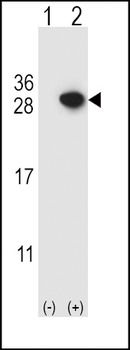 ARHGDIA Antibody (C-term)