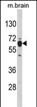PHGDH Antibody (N-term)