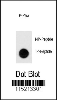 Phospho-TEK(Y1113) Antibody