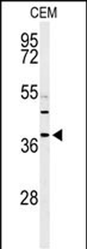 RNASEH2B Antibody (Center)