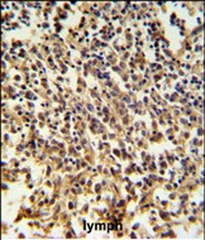 RNASEH2B Antibody (Center)