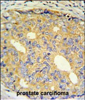 ZNF9 Antibody (Center)