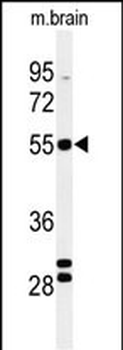 FA2H Antibody (Center)