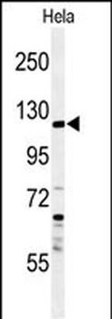 SYTL2 Antibody (Center)
