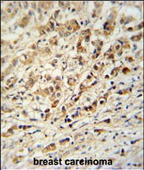 AVL9 Antibody (C-term)