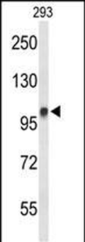DDX23 Antibody (Center)