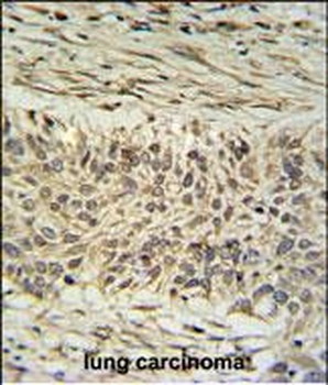 DDX23 Antibody (Center)