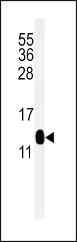 DC13 Antibody (N-term)