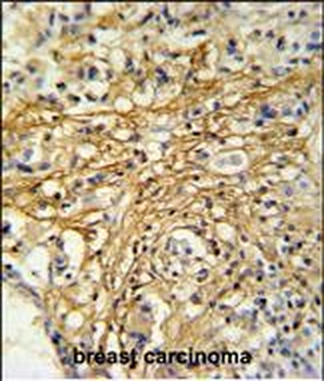 DC13 Antibody (N-term)