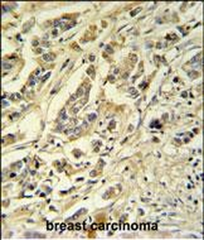 ASM3A Antibody (C-term)