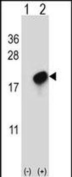 CMTM7 Antibody (N-term)