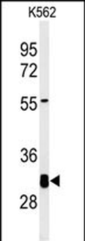KCTD7 Antibody (Center)