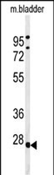 TPRGL Antibody (N-term)