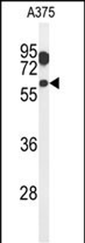 ZACN Antibody (C-term)