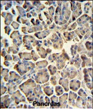 ZACN Antibody (C-term)