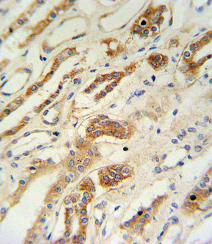 ZFYVE16 Antibody (N-term)