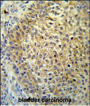 TM222 Antibody (Center)