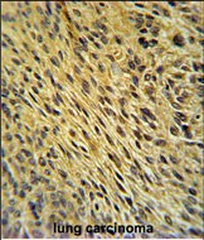 CCDC62 Antibody (C-term)