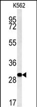 ELP6 Antibody (C-term)