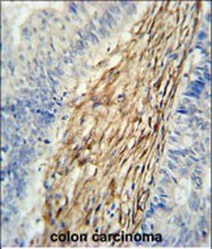 ELP6 Antibody (C-term)