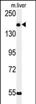 KIAA1529 Antibody (C-term)