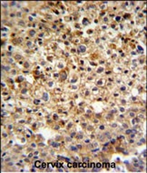 KIAA1529 Antibody (C-term)