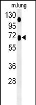 ASB15 Antibody (Center)