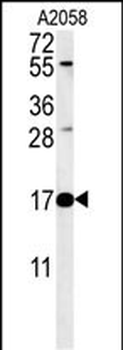 RNASEK Antibody (Center)