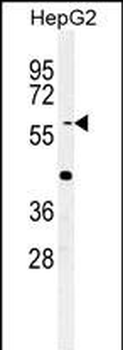YLAT2 Antibody (C-term)
