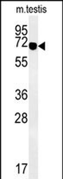 ZBTB5 Antibody (N-term)
