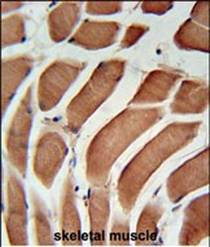SIKE Antibody (C-term)