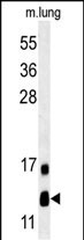 LYRM2 Antibody (N-term)