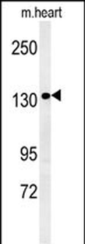 ANKRD32 Antibody (N-term)