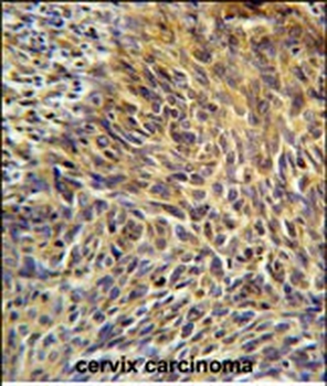 ANKRD32 Antibody (N-term)