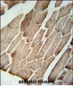 SLC9A9 Antibody (C-term)