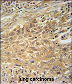 CNNM4 Antibody (Center)