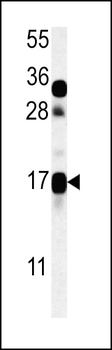 CSAG2 Antibody (N-term)