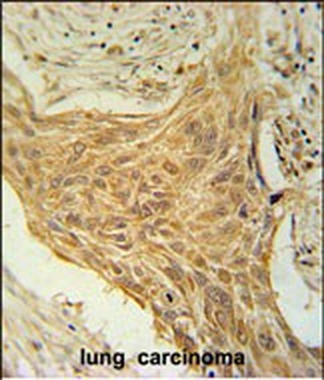 CSAG2 Antibody (N-term)