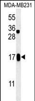 SMIM14 Antibody (C-term)