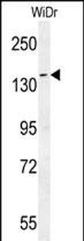 DAAM1-T361 Antibody (N-term)
