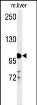 NR3C1 Antibody (Center)