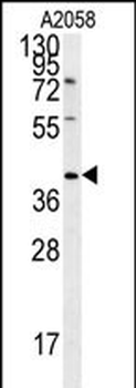 CD99L2 Antibody (Center)
