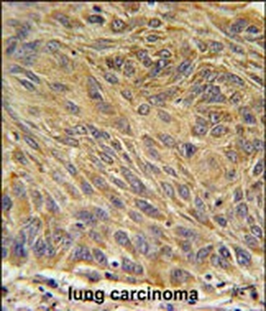 CD99L2 Antibody (Center)